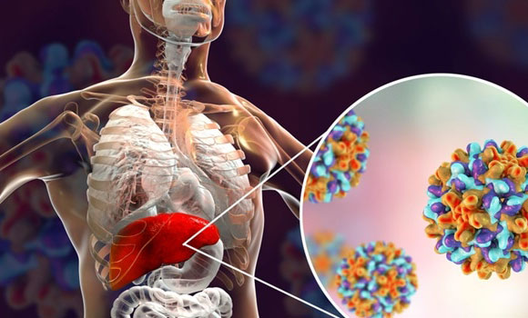 Liver Hepatitis Treatment