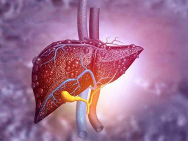 Liver Transplant Surgery